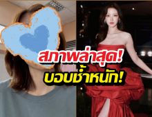 ตกใจแรง! ใบเฟิร์น พิมพ์ชนก สภาพล่าสุดบอบช้ำหนัก