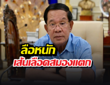 ด่วน...ลือหนักฮุนเซน เส้นเลือดสมองแตก จ่อตุยเย่แล้ว?